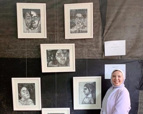 "40% ميلانين" مشروع تخرج يناقش مرض البهاق للفنانة يارا عادل